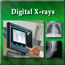 digital chiropractic x-rays