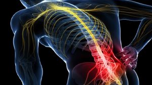 Chiropractic Treatment for Sciatica Neve Pain