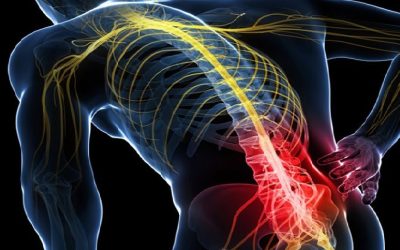 Chiropractic Care and Treatment for Sciatica Pain